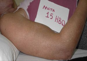 κ18